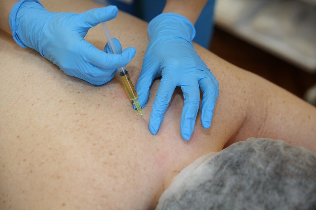 sırt için kondroprotektör enjeksiyonları